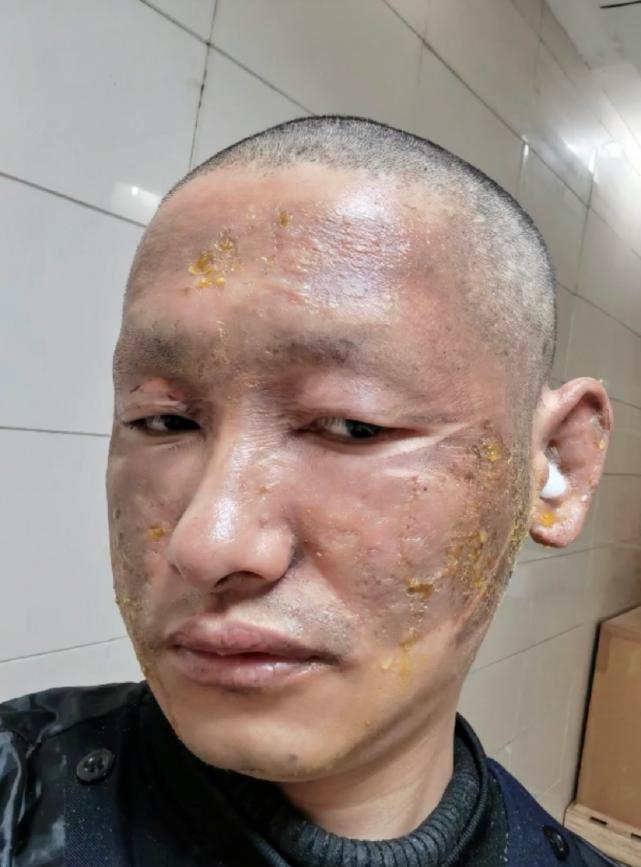 探索星光的奧秘，明星天臉重塑魅力的奇跡之旅