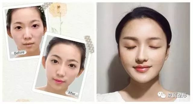 最新眉部美容技術(shù)，塑造完美眉型，瞬間驚艷全場(chǎng)的美顏秘訣 ???