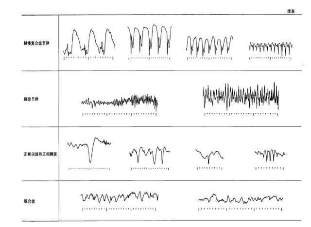 視頻腦電圖之旅，愛與陪伴的溫馨故事探尋價(jià)格揭秘