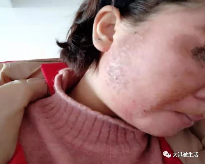 最新寶顏術(shù)，探索美容新境界的奧秘